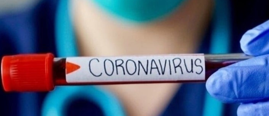 Κορωνοϊός τεστ Covid-19